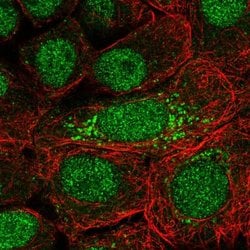 Invitrogen DOPEY2 Polyclonal Antibody 100 &mu;L; Unconjugated:Antibodies,
