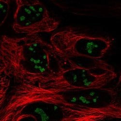 Invitrogen CC2D2B Polyclonal Antibody 100 &mu;L; Unconjugated:Antibodies,
