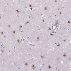 MAGEB3 Polyclonal Antibody:Antibodies, Polyclonal