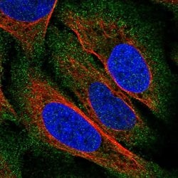 ZDHHC22 Polyclonal Antibody:Antibodies, Polyclonal