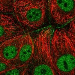 Invitrogen C6orf165 Polyclonal Antibody 100 &mu;L; Unconjugated:Antibodies,