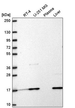 Invitrogen RPL31 Polyclonal Antibody 100 &mu;L; Unconjugated:Antibodies,