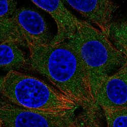 Invitrogen RABGAP1 Polyclonal Antibody 100 &mu;L; Unconjugated:Antibodies,