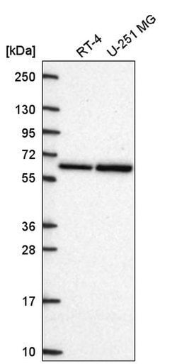 CPEB2 Polyclonal Antibody, Invitrogen 100 &mu;L; Unconjugated:Antibodies,