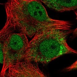 Invitrogen TMEM14A Polyclonal Antibody 100 &mu;L; Unconjugated:Antibodies,