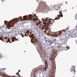 Invitrogen DEPDC1B Polyclonal Antibody 100 &mu;L; Unconjugated:Antibodies,