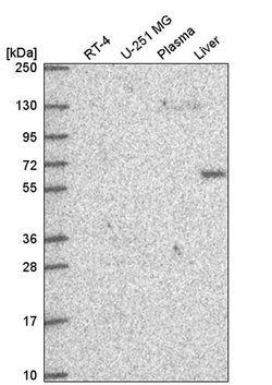 Invitrogen DEPDC1B Polyclonal Antibody 100 &mu;L; Unconjugated:Antibodies,