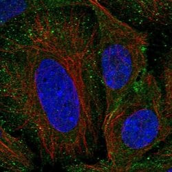 Invitrogen SHFM1 Polyclonal Antibody 100 &mu;L; Unconjugated:Antibodies,