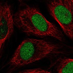 ETNPPL Isoform 1 Polyclonal Antibody:Antibodies, Polyclonal