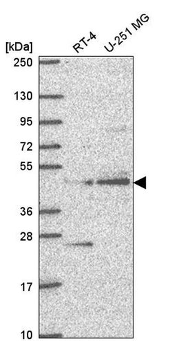 ETNPPL Isoform 1 Polyclonal Antibody:Antibodies, Polyclonal