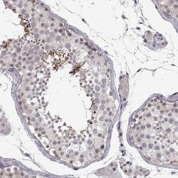Invitrogen C10orf62 Polyclonal Antibody 100 &mu;L; Unconjugated:Antibodies,