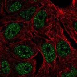 Invitrogen ZNF283 Polyclonal Antibody 100 &mu;L; Unconjugated:Antibodies,