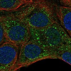 Invitrogen G6B Polyclonal Antibody 100 &mu;L; Unconjugated:Antibodies,