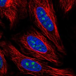 Invitrogen PCID2 Polyclonal Antibody 100 &mu;L; Unconjugated:Antibodies,