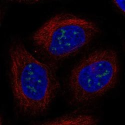 Invitrogen UBE2W Polyclonal Antibody 100 &mu;L; Unconjugated:Antibodies,