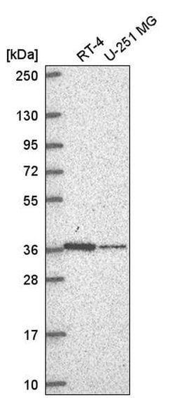 Invitrogen NDUFA9 Polyclonal Antibody 100 &mu;L; Unconjugated:Antibodies,