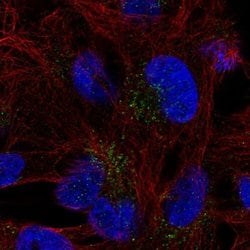 Invitrogen FAM78B Polyclonal Antibody 100 &mu;L; Unconjugated:Antibodies,