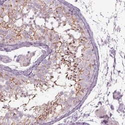 Invitrogen Septin-14 Polyclonal Antibody 100 &mu;L; Unconjugated:Antibodies,