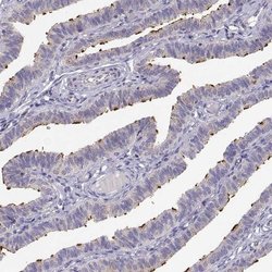 Invitrogen KIF19 Polyclonal Antibody 100 &mu;L | Buy Online | Invitrogen&trade; | Fisher Scientific