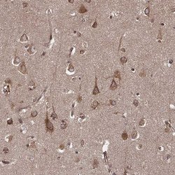 Invitrogen AGPAT1 Polyclonal Antibody 100 &mu;L; Unconjugated:Antibodies,