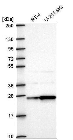 Invitrogen AGPAT1 Polyclonal Antibody 100 &mu;L; Unconjugated:Antibodies,