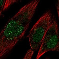Invitrogen PCDH10 Polyclonal Antibody 100 &mu;L; Unconjugated:Antibodies,