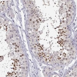 Invitrogen C16orf86 Polyclonal Antibody 100 &mu;L; Unconjugated:Antibodies,