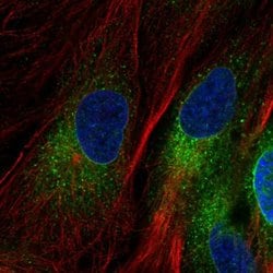 YIPF5 Polyclonal Antibody, Invitrogen 100 &mu;L; Unconjugated:Antibodies,