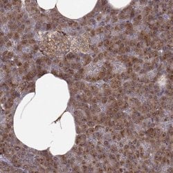 YIPF5 Polyclonal Antibody, Invitrogen 100 &mu;L; Unconjugated:Antibodies,