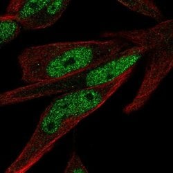 Invitrogen ZNF225 Polyclonal Antibody 100 &mu;L; Unconjugated:Antibodies,