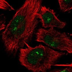 Invitrogen DHX33 Polyclonal Antibody 100 &mu;L; Unconjugated:Antibodies,