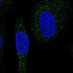Invitrogen SNX24 Polyclonal Antibody 100 &mu;L | Buy Online | Invitrogen&trade; | Fisher Scientific