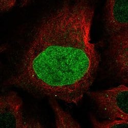 Invitrogen™ Calpain 8 Polyclonal Antibody