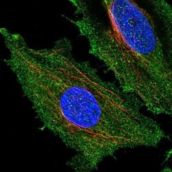 Invitrogen HYDIN Polyclonal Antibody 100 &mu;L; Unconjugated:Antibodies,