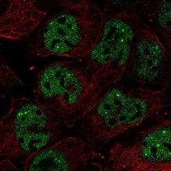 Invitrogen RNF34 Polyclonal Antibody 100 &mu;L; Unconjugated:Antibodies,