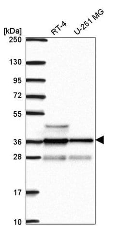 Invitrogen RNF34 Polyclonal Antibody 100 &mu;L; Unconjugated:Antibodies,