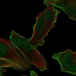 Invitrogen PALM2 Polyclonal Antibody 100 &mu;L; Unconjugated:Antibodies,