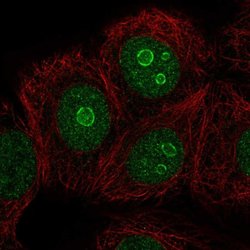 Invitrogen METTL22 Polyclonal Antibody 100 &mu;L; Unconjugated:Antibodies,