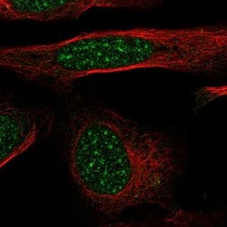 Invitrogen GTF2H4 Polyclonal Antibody 100 &mu;L; Unconjugated:Antibodies,