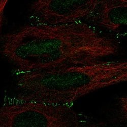 Invitrogen ALKBH6 Polyclonal Antibody 100 &mu;L; Unconjugated:Antibodies,