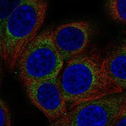 Invitrogen AP3D1 Polyclonal Antibody 100 &mu;L; Unconjugated:Antibodies,