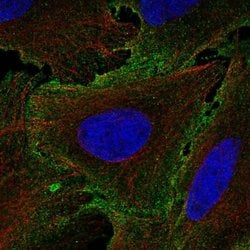 Invitrogen IL12RB1 Polyclonal Antibody 100 &mu;L; Unconjugated:Antibodies,