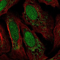 Invitrogen FASTKD3 Polyclonal Antibody 100 &mu;L; Unconjugated:Antibodies,