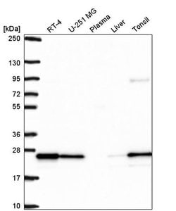 Invitrogen RAB8B Polyclonal Antibody 100 &mu;L | Buy Online | Invitrogen&trade; | Fisher Scientific