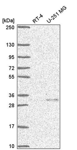 Invitrogen UCH37 Polyclonal Antibody 100 &mu;L | Buy Online | Invitrogen&trade; | Fisher Scientific