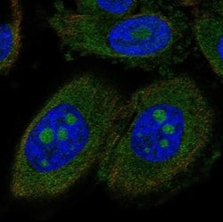 CCDC7 Polyclonal Antibody, Invitrogen 100 &mu;L; Unconjugated:Antibodies,