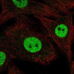 Invitrogen RFWD3 Polyclonal Antibody 100 &mu;L; Unconjugated:Antibodies,
