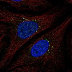 Invitrogen STEAP4 Polyclonal Antibody 100 &mu;L; Unconjugated:Antibodies,