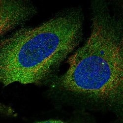 PLS3 Polyclonal Antibody:Antibodies, Polyclonal