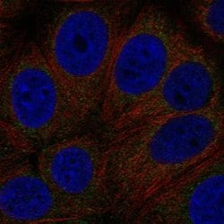 Invitrogen GPR89A Polyclonal Antibody 100 &mu;L; Unconjugated:Antibodies,